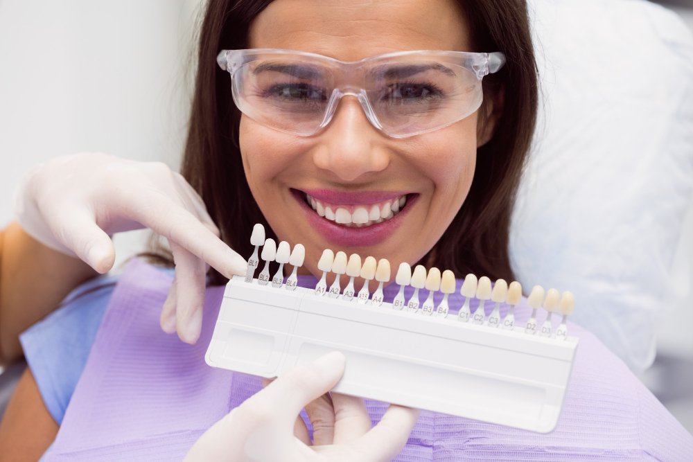 lentes de contato dental